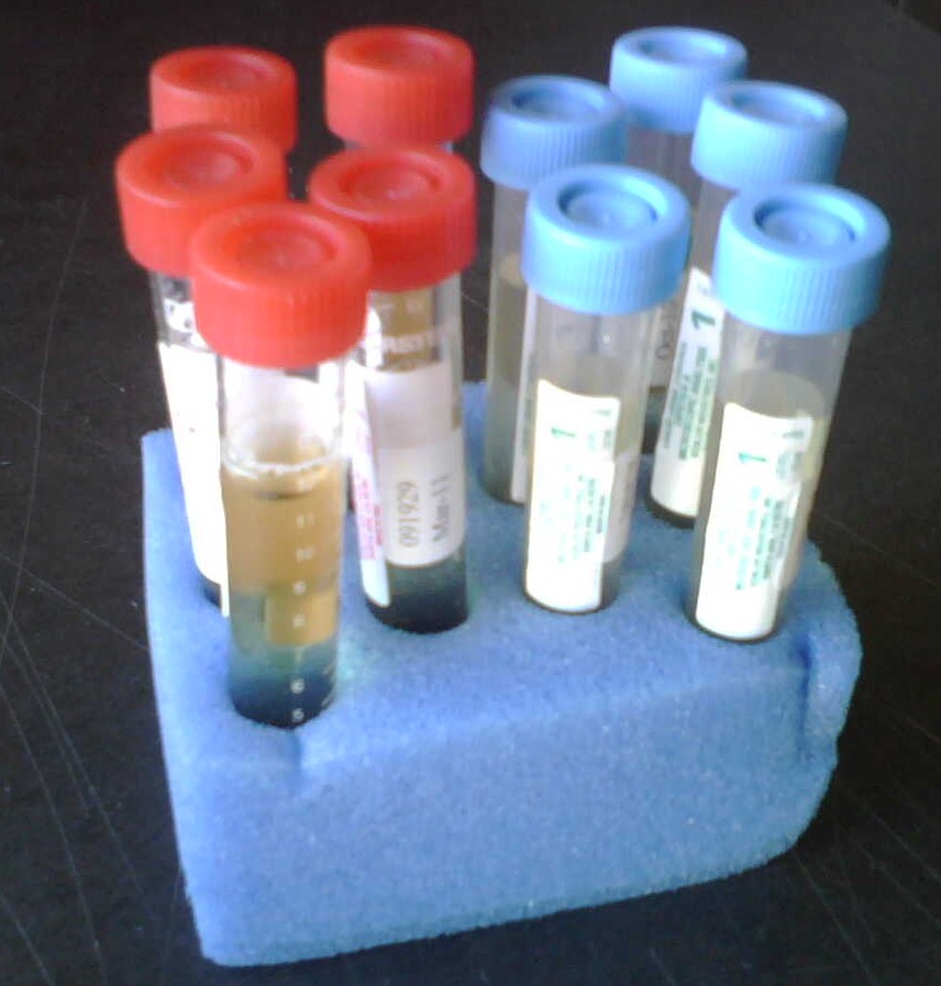 Liquid Urine Control Microscopic